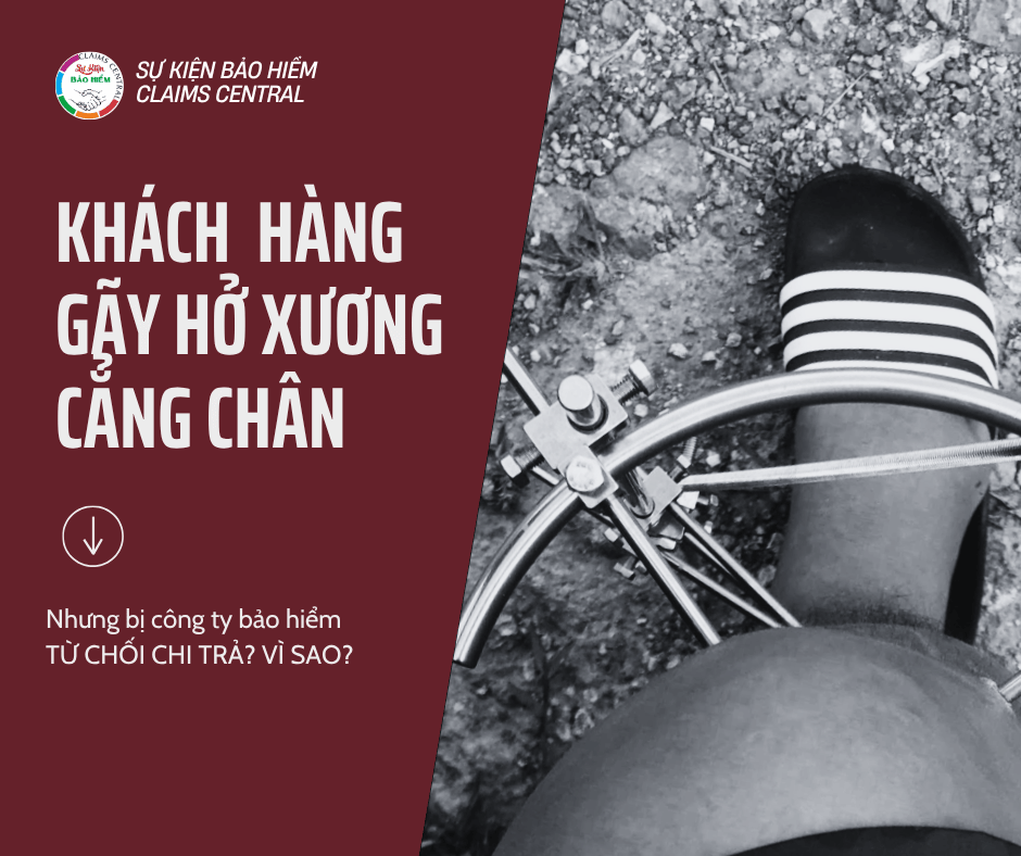 Khách hàng gãy xương nhưng bị CTBH từ chối chi trả ? Vì sao?